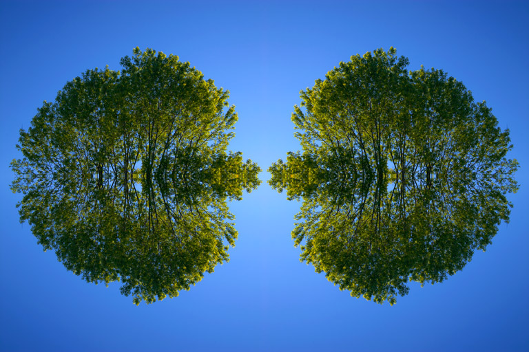 279 - Arboreal Brain